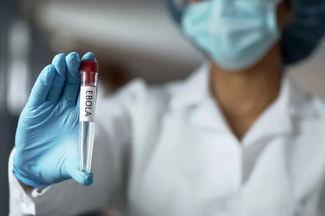 Primul caz de Ebola confirmat în Franța
